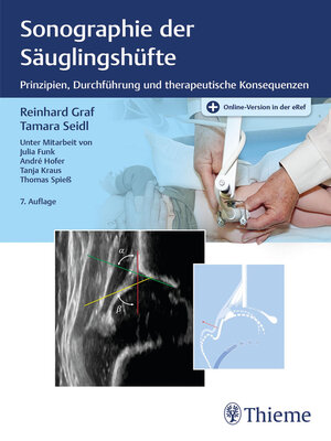 cover image of Sonographie der Säuglingshüfte